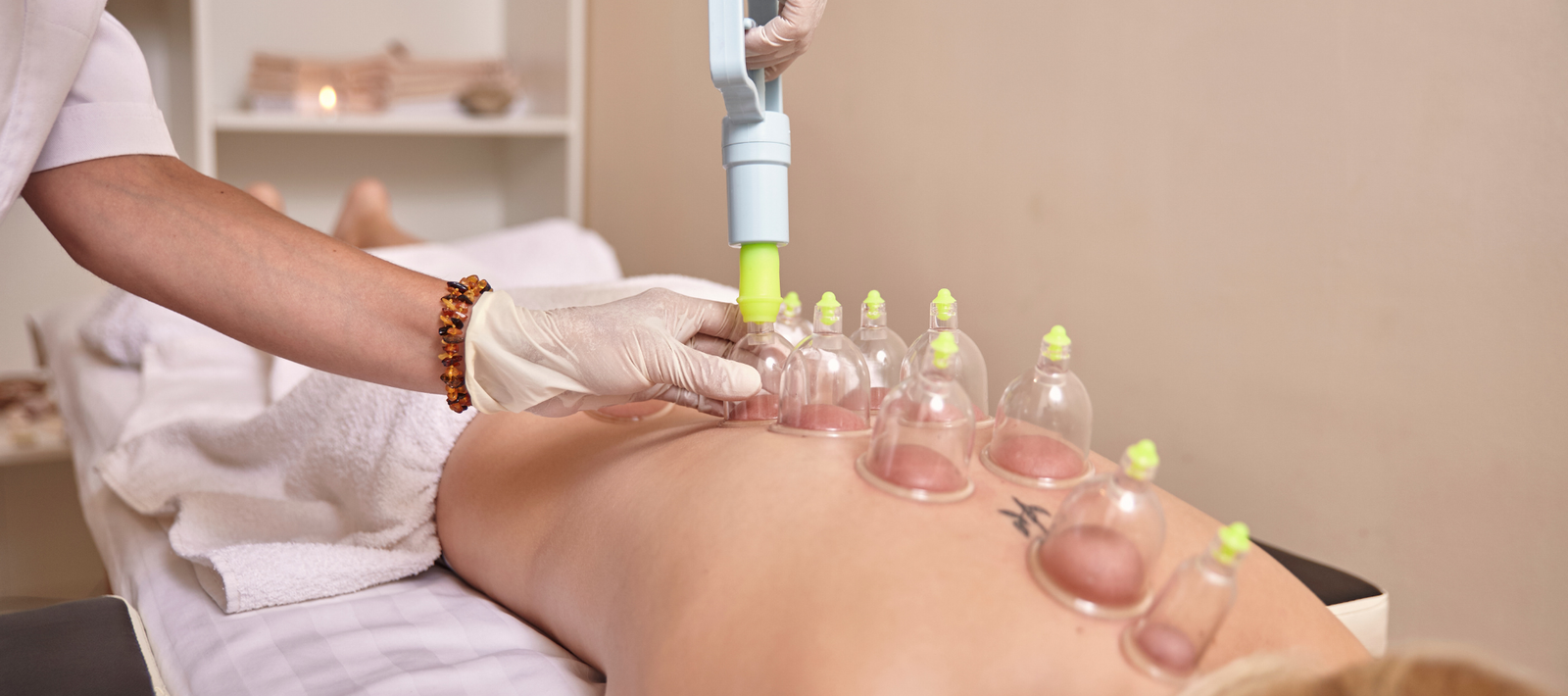 Dry cupping therapy back pain noida extension vacucare
