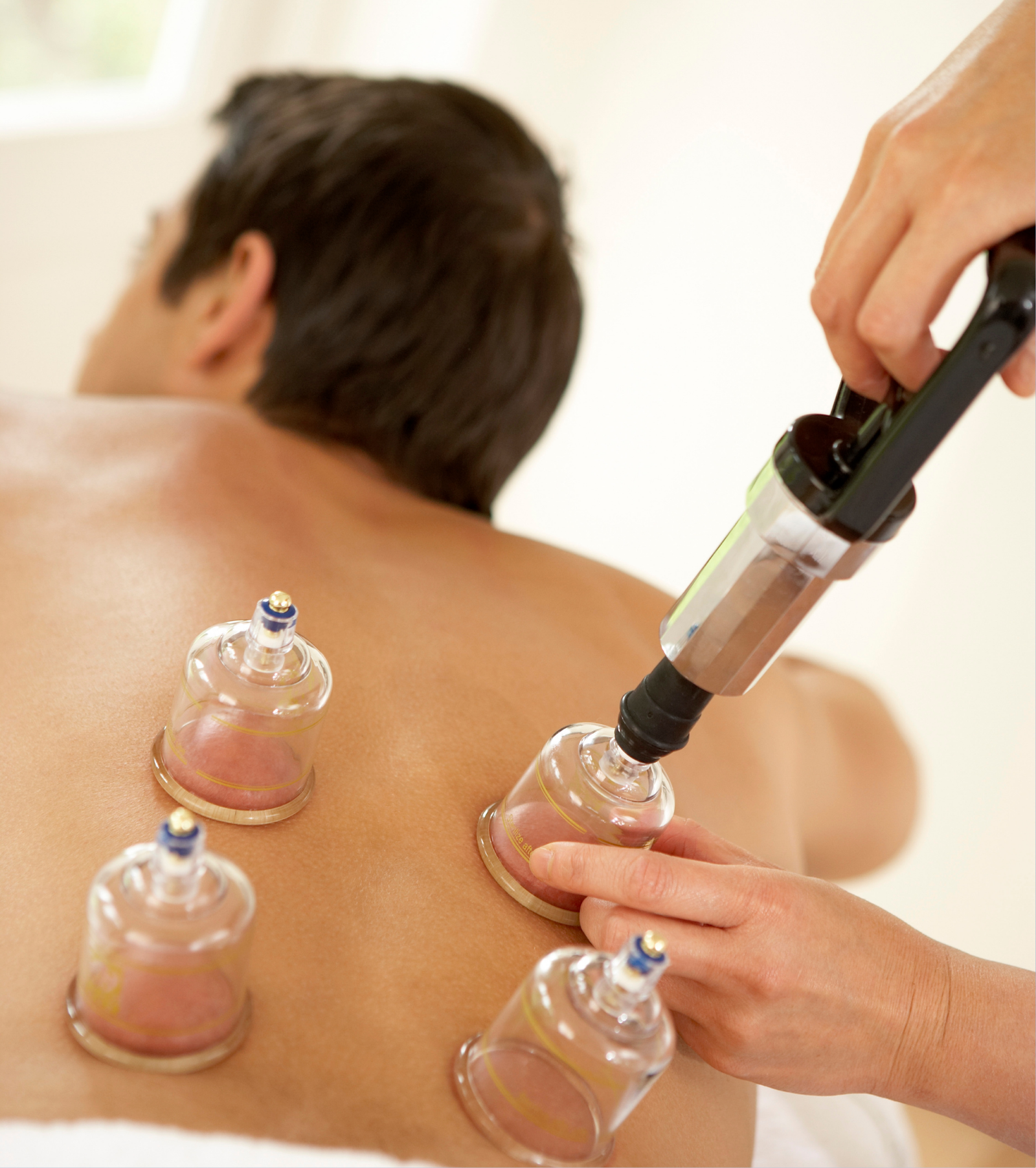 cupping therapy near me