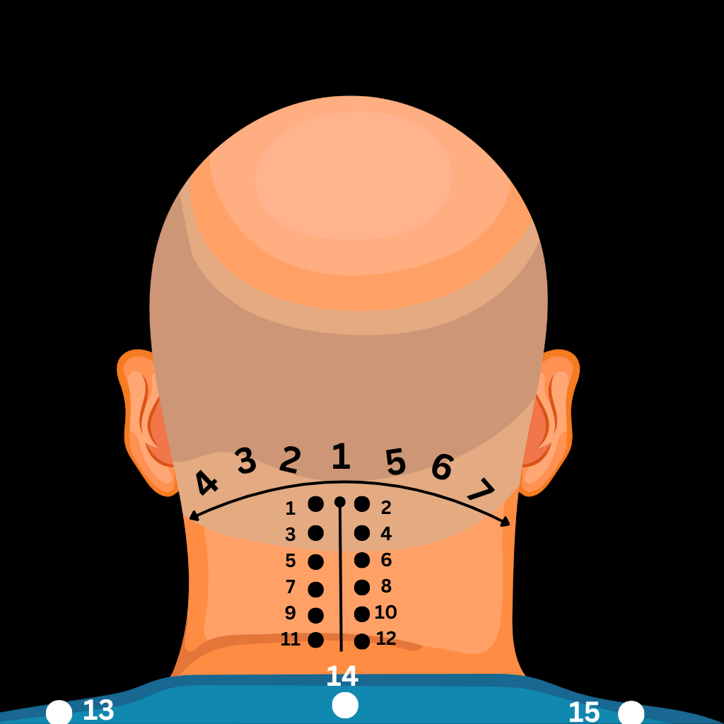 Acupressure Points migraine problem